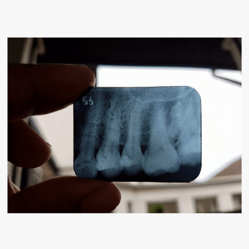 Dental-Film-05